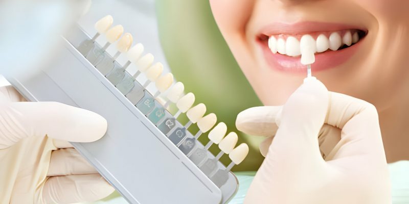 Benefits of Cosmetic Dentistry in Westchase, TX