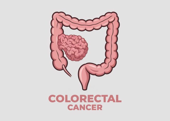 Advancements in Colorectal Surgery: What Patients Should Know