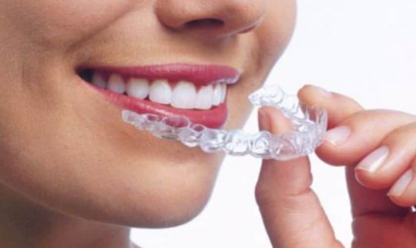 Perfect Your Smile with Invisalign in Tallahassee, FL