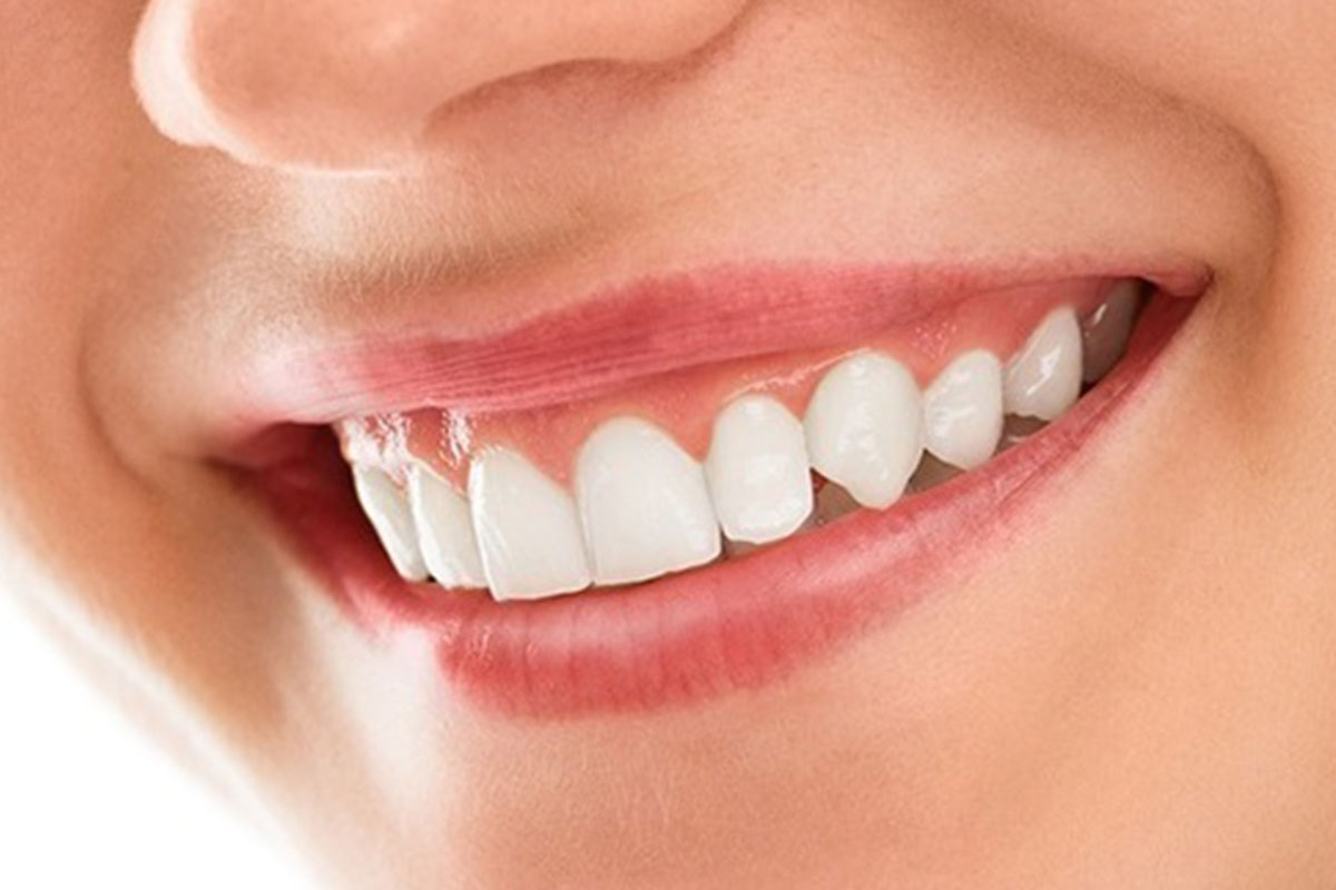 Transform Your Smile with Cosmetic Dentistry in Cantonment FL