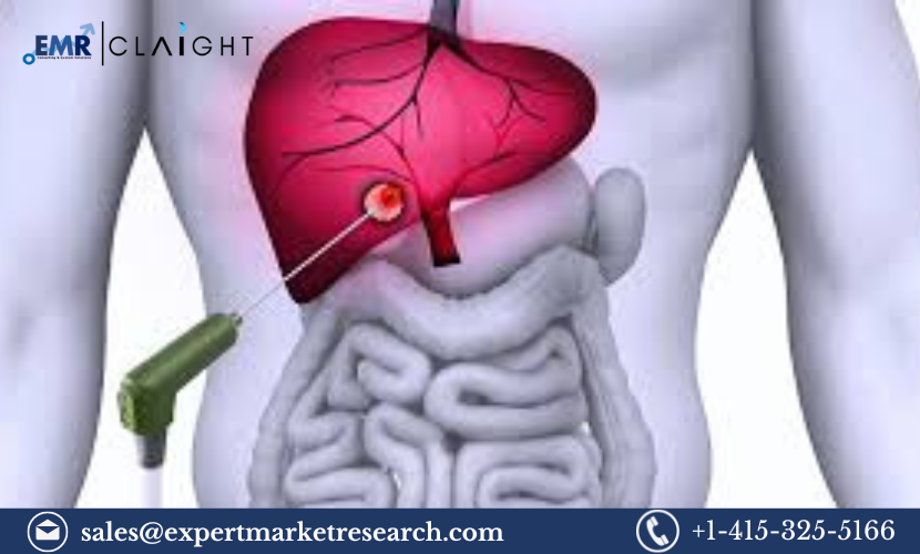 Asia Tumor Ablation Market