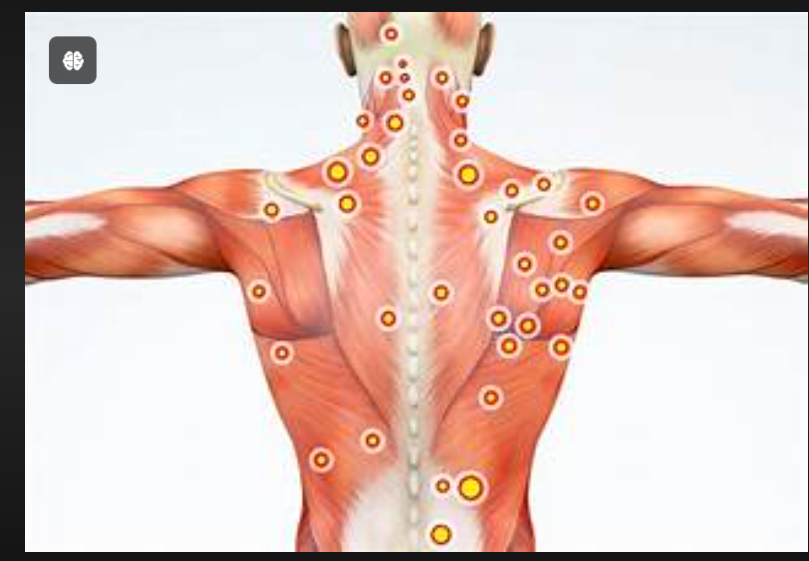 Trigger Point Massage