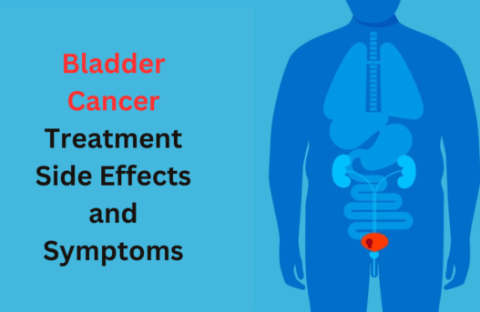 Bladder Cancer Treatment Side Effects and Symptoms