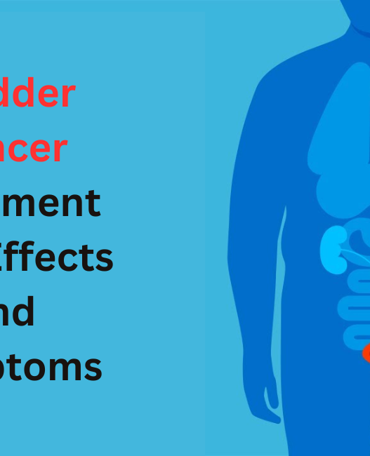 Bladder Cancer Treatment Side Effects and Symptoms