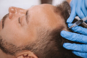 Hair Transplant Cost