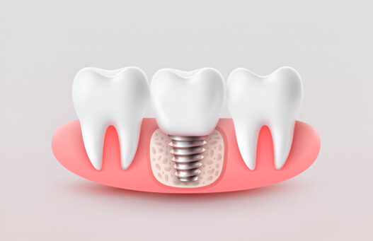 Dental Implant Specialists in Aberdeen