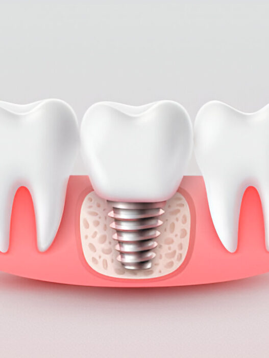 Dental Implant Specialists in Aberdeen