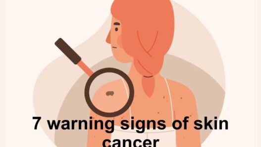 Skin cancer is one of the most common types of cancer, with millions of cases diagnosed worldwide each year.