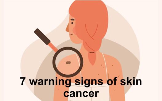 Skin cancer is one of the most common types of cancer, with millions of cases diagnosed worldwide each year.