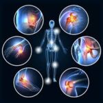 Aspadol 100mg Chronic Pain