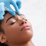 botox injector torrance