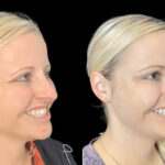Trusted and Experienced: Best Doctors in Dubai for Botox