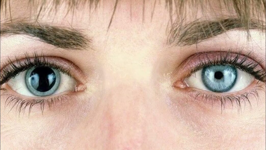 pinpoint pupil