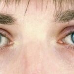 pinpoint pupil
