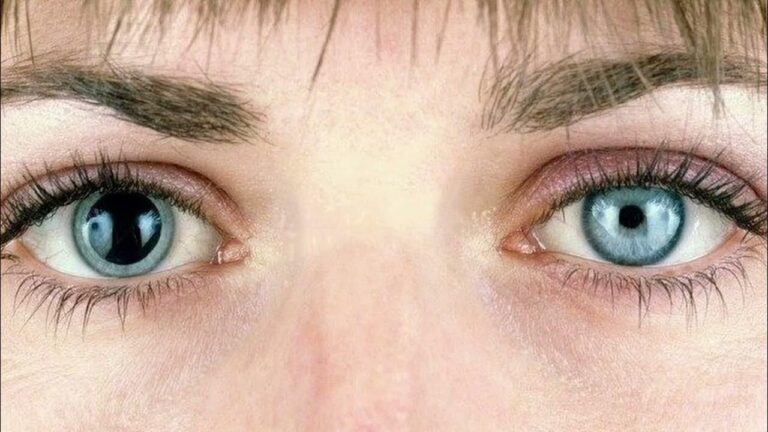 pinpoint pupil