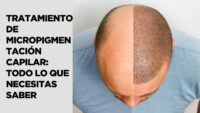 tratamiento de micropigmentacion capilar
