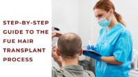 FUE hair transplant