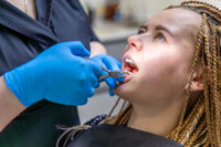 Missing Teeth Repair in Peoria