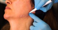 How a Plastic Surgeon Delivers Jawline Enhancement?