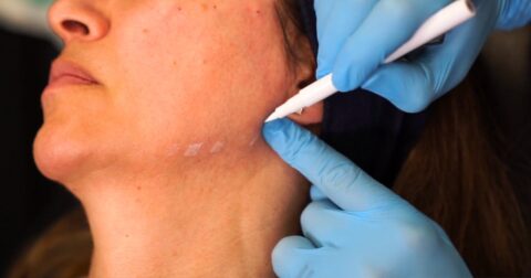 How a Plastic Surgeon Delivers Jawline Enhancement?