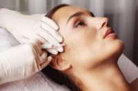 Skin whitening treatment in islamabad