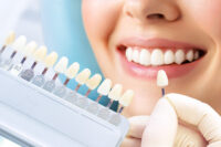 Italian dental clinic dubai