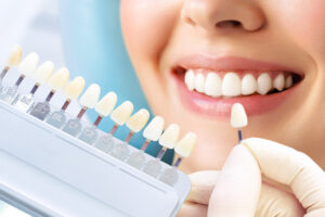 Italian dental clinic dubai