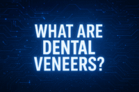 dental veneers